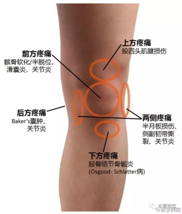 是一种很常见的症状,给人们的生活带来很多困扰,膝盖疼的治疗方法有