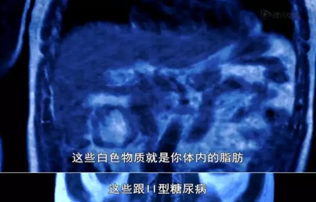 BBC 2016《锻炼的真相!》调查: 彻底颠覆了我们的“常识”