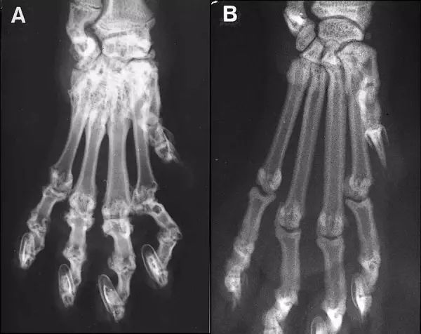 a图是发病的苏格兰折耳猫前肢的x光片,出现了严重的骨质增生,b图是