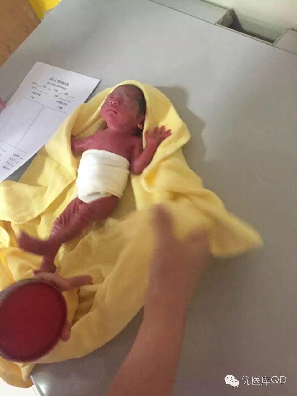 国内罕见!怀孕25周产下三胞胎,巴掌大“小虎队”均救治存活,而且很健康-怀孕期