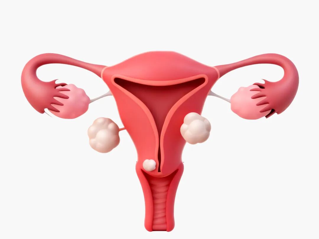 美国ASRM生殖医学会科普：子宫肌瘤从何而来？是否影响试管受孕成功率？