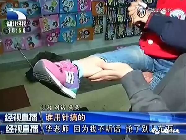 武汉女童疑在幼儿园遭针扎！监控视频却离奇消失