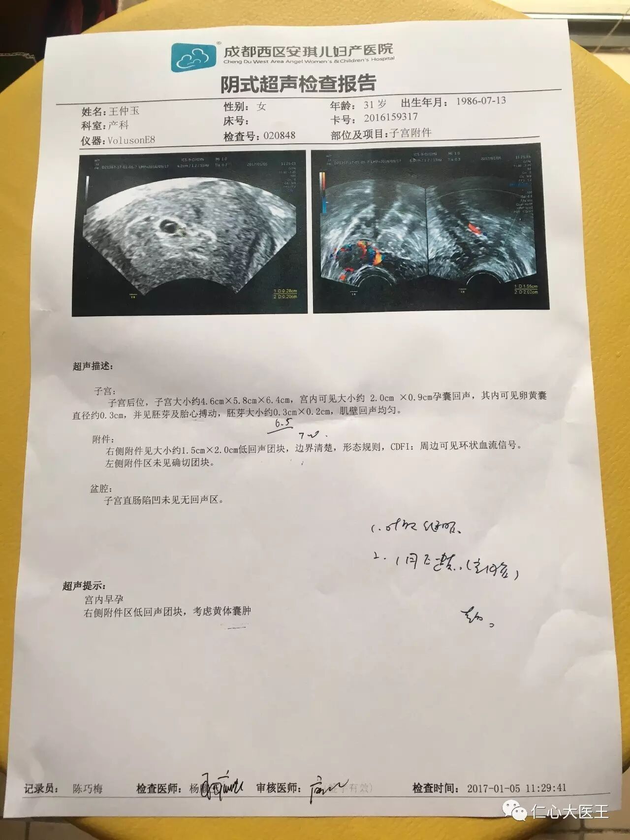盆腔粘连输卵管不通,一度求子无门.7个月后竟然怀孕令我喜极而泣(附疾病治愈方法)-怀孕期