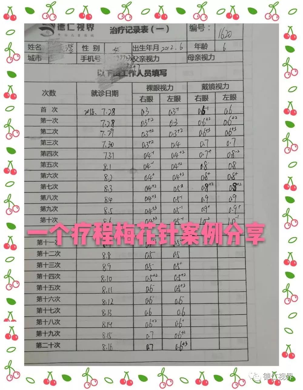 李氏梅花针是如何调理中高度散光弱视?孩子散光能提高裸眼视力吗?