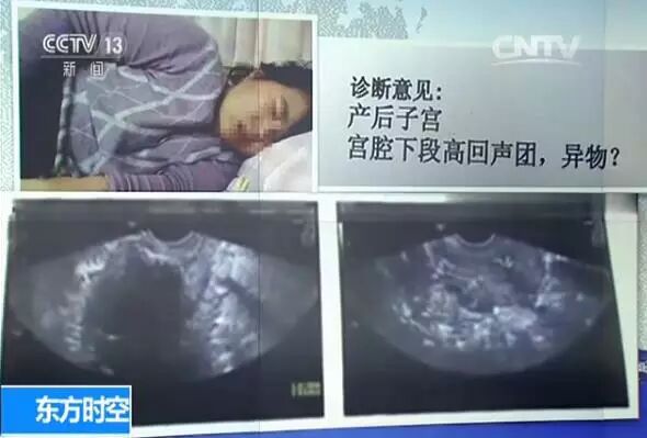 为什么医院的纱布不卖“合理”还是“事故”？央视“定性”纱布门_https://www.jmylbn.com_新闻资讯_第16张