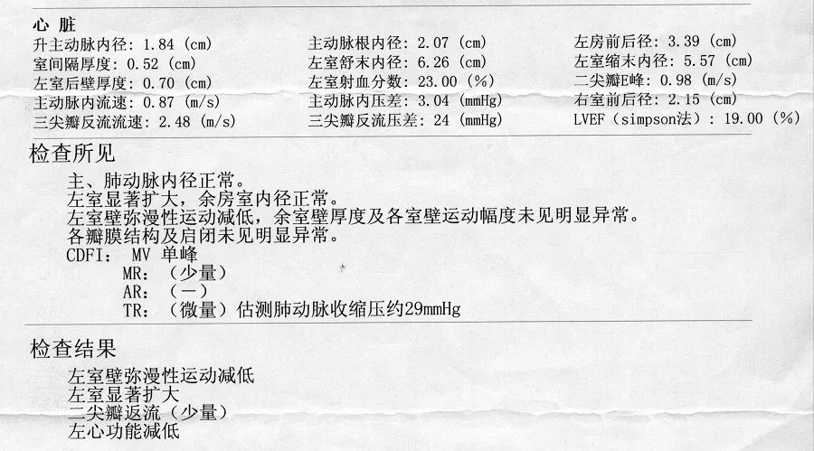 心脏扩大原因待查 扩张性心肌病可能性大 病毒性心肌炎?