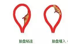 为什么医院的纱布不卖1分钟成功取出纱布，索赔300000块钱，滞留医院100800分钟，这么闹，好玩吗？_https://www.jmylbn.com_新闻资讯_第7张