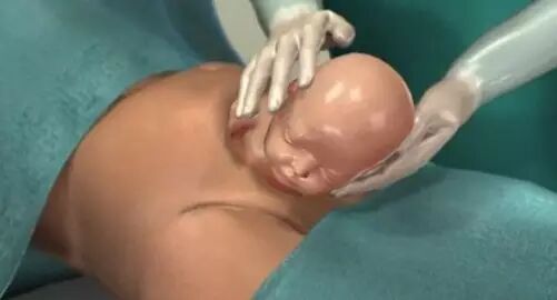 为什么医院的纱布不卖1分钟成功取出纱布，索赔300000块钱，滞留医院100800分钟，这么闹，好玩吗？_https://www.jmylbn.com_新闻资讯_第3张