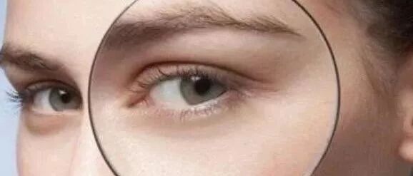 倾雪世颜护肤 脂肪粒不能忽视 倾雪世颜化妆品有限公司 微信公众号文章阅读 Wemp