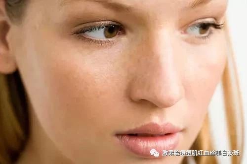 朵嘉浓大闫:为什么你的皮肤越来越黑,黯淡无光?