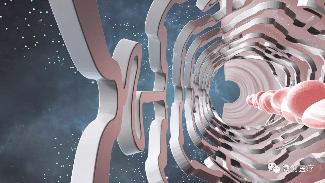 火鹰支架怎么样荣誉 ｜ Firehawk®（火鹰）在第三批优秀国产医疗设备产品遴选临床评价部分获得满分_https://www.jmylbn.com_新闻资讯_第3张