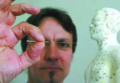 针灸铜人的前世今生你知道多少？Ta能把中医在国外带火吗？