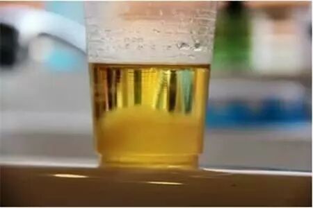 尿白细胞增多，是尿路感染了？要吃消炎药吗？