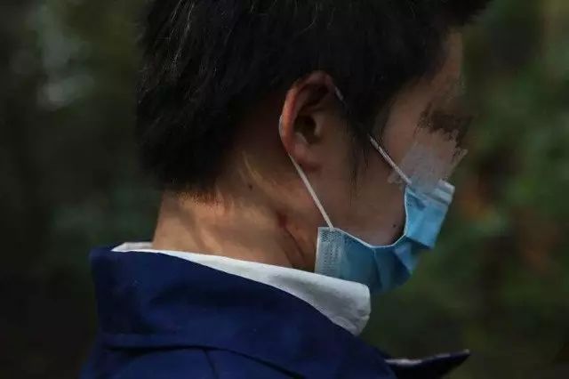 老虎伤人事件受害者赵女士