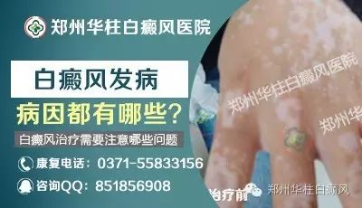 迈克尔杰克逊白癜风,白癜风治疗费用贵吗,哪里治疗白癜风