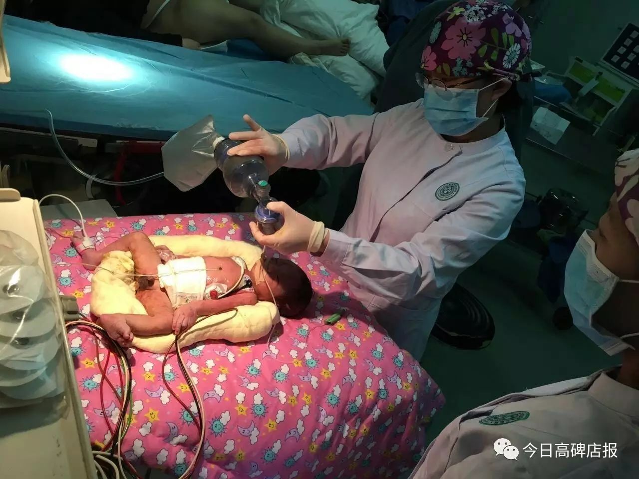 还有一个鸡宝宝,出生后,立即进入nicu进行抢救!
