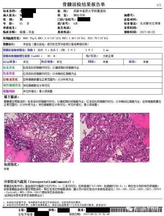 骨髓活检