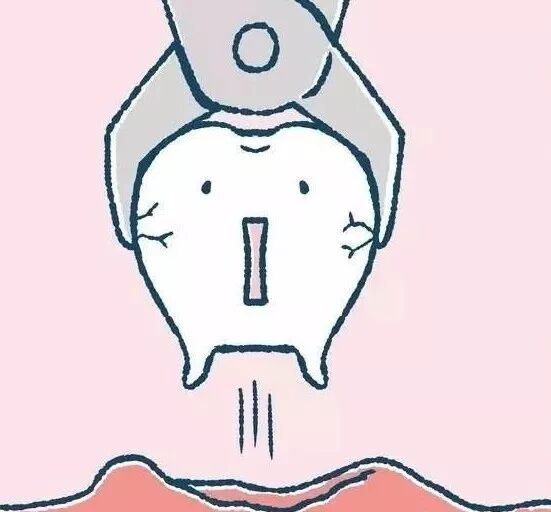 传统牙套和自锁牙套_自锁牙套需要拔牙吗_自锁牙套