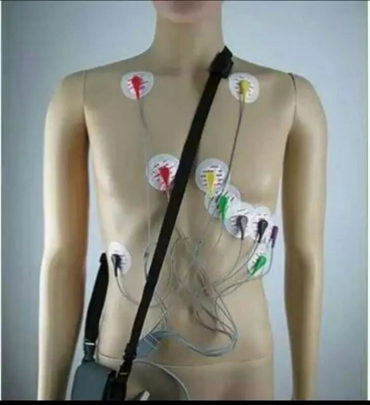 动态心电图接头怎么接【介绍】动态心电图_https://www.jmylbn.com_新闻资讯_第5张