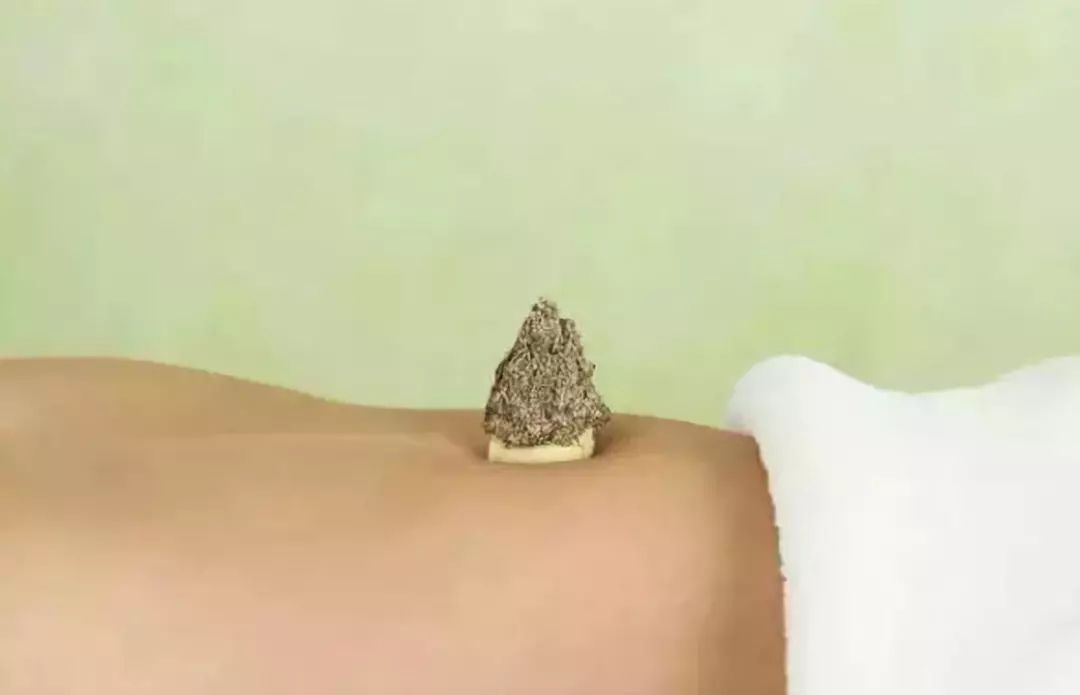 神阙穴的功效及艾灸方法
