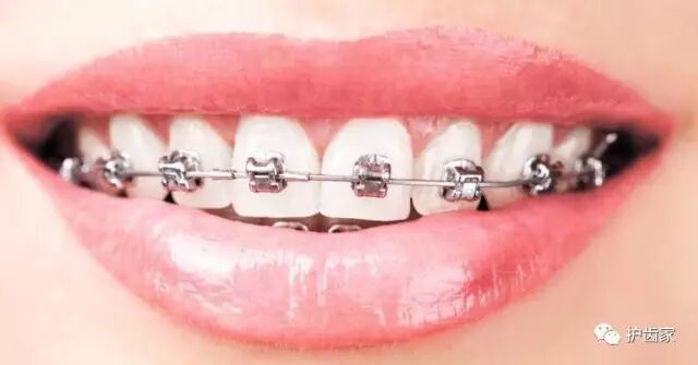 我的虎牙长得很丑，为什么医生不让我拔掉？