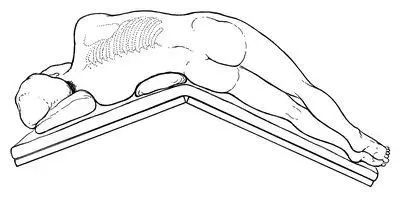 是在侧卧位的基础上再将病人躯体向前倾斜450左右.