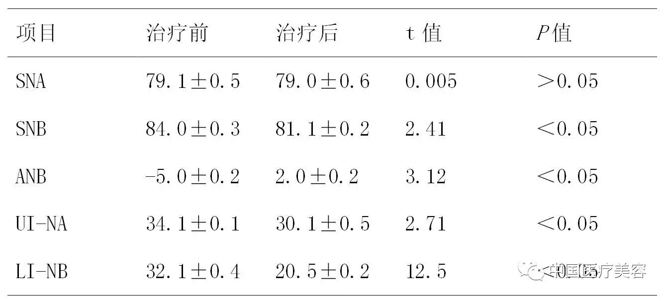 表1 治疗前后患者头影测量数据比较[(x±s),°]