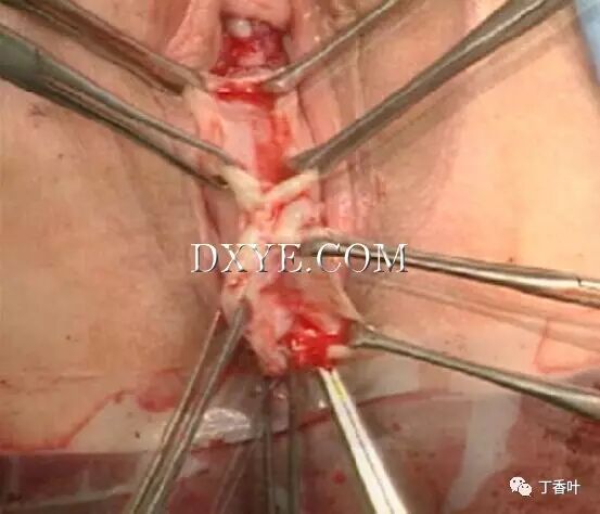 s拉钩怎么用RICHTER