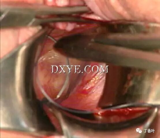 s拉钩怎么用RICHTER