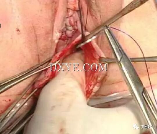 s拉钩怎么用RICHTER