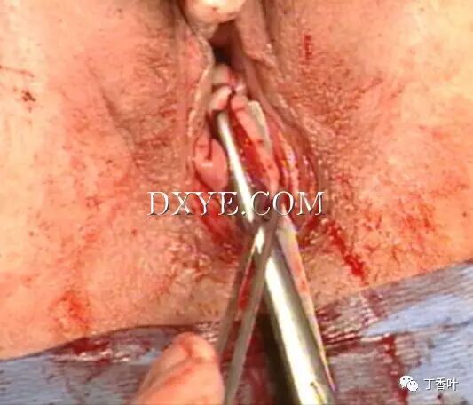 s拉钩怎么用RICHTER