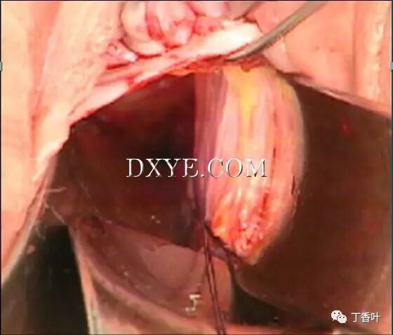 s拉钩怎么用RICHTER