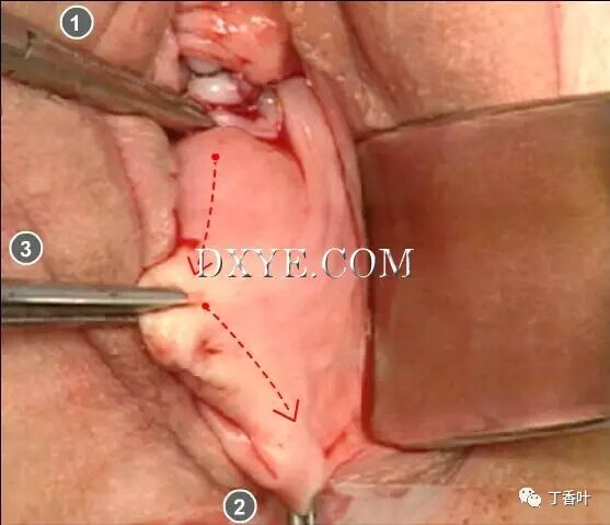 s拉钩怎么用RICHTER