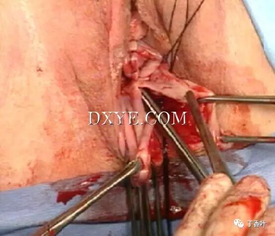 s拉钩怎么用RICHTER