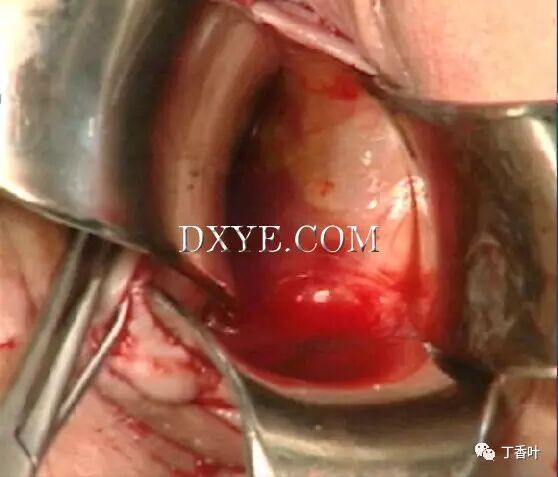 s拉钩怎么用RICHTER