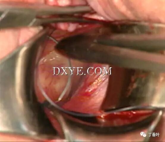 s拉钩怎么用RICHTER