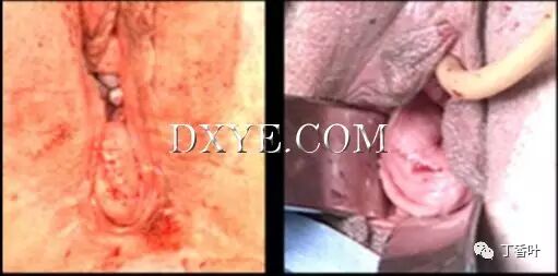 s拉钩怎么用RICHTER