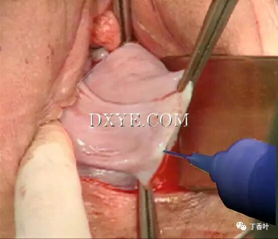 s拉钩怎么用RICHTER