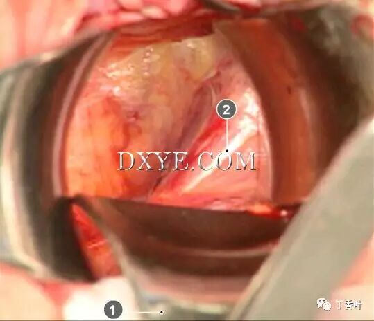 s拉钩怎么用RICHTER