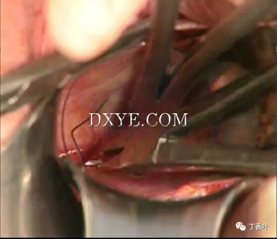 s拉钩怎么用RICHTER