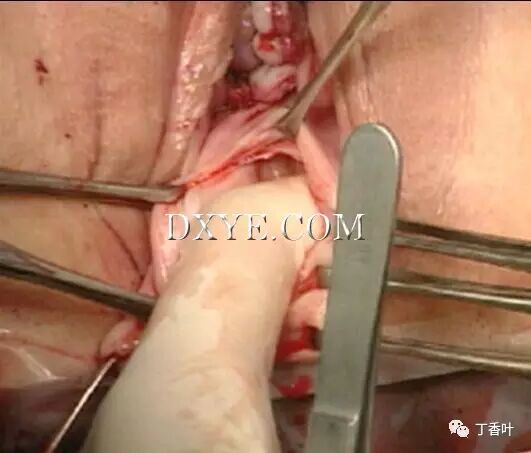 s拉钩怎么用RICHTER