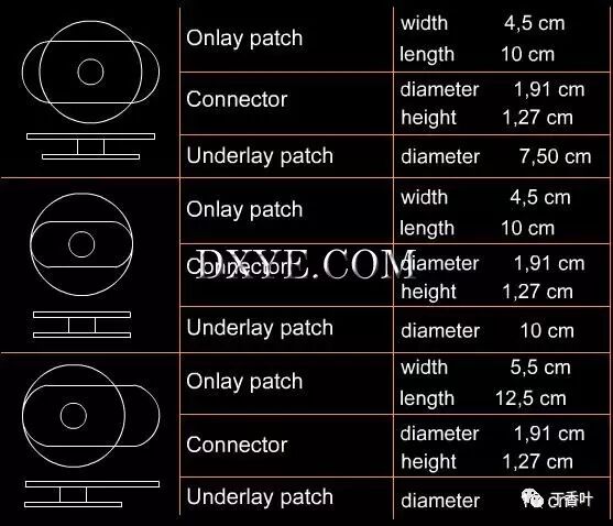 疝气补片怎么固定双层补片修补腹股沟疝（图文演示）_https://www.jmylbn.com_新闻资讯_第60张