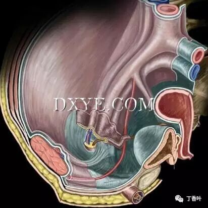 疝气补片怎么固定双层补片修补腹股沟疝（图文演示）_https://www.jmylbn.com_新闻资讯_第52张