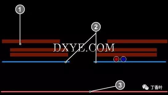 疝气补片怎么固定双层补片修补腹股沟疝（图文演示）_https://www.jmylbn.com_新闻资讯_第65张