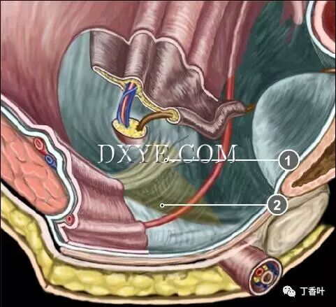 疝气补片怎么固定双层补片修补腹股沟疝（图文演示）_https://www.jmylbn.com_新闻资讯_第6张