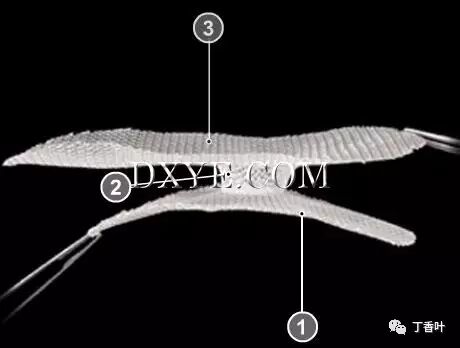 疝气补片怎么固定双层补片修补腹股沟疝（图文演示）_https://www.jmylbn.com_新闻资讯_第61张