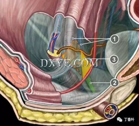 疝气补片怎么固定双层补片修补腹股沟疝（图文演示）_https://www.jmylbn.com_新闻资讯_第7张