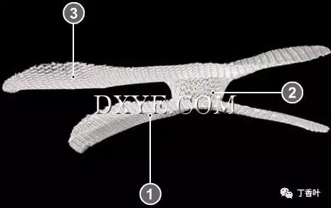 疝气补片怎么固定双层补片修补腹股沟疝（图文演示）_https://www.jmylbn.com_新闻资讯_第51张