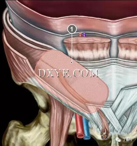 疝气补片怎么固定双层补片修补腹股沟疝（图文演示）_https://www.jmylbn.com_新闻资讯_第76张