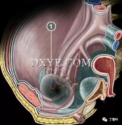 疝气补片怎么固定双层补片修补腹股沟疝（图文演示）_https://www.jmylbn.com_新闻资讯_第64张